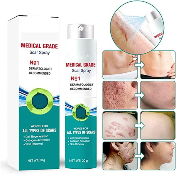 Scar Spray - Cure All Type of Scars