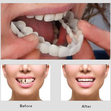 Snap On Smile - Veneer Teeth