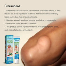 Lipoma Remover Cream