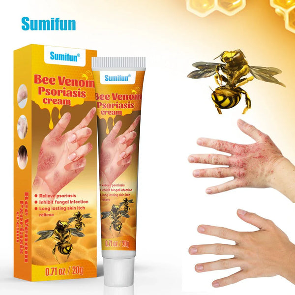 Bee Venom Psoriasis Care Cream